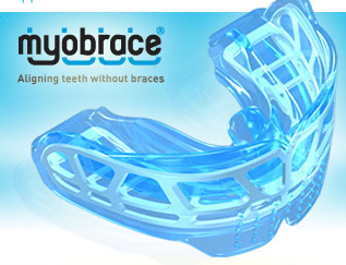 Myobrace Smile Point Dental Myobrace Smile Point Dental